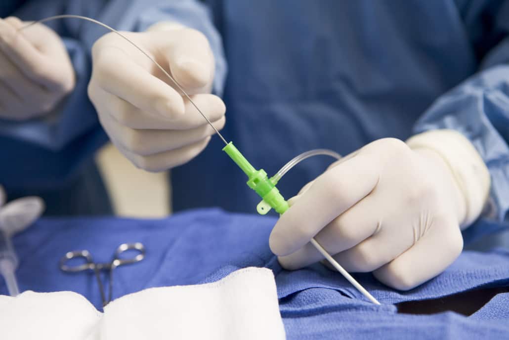 Surgeon Inserting Tube Into Patient During Surgery