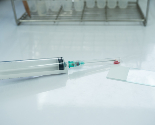 Close up doctor hand holding syringe during smear fine needle aspiration