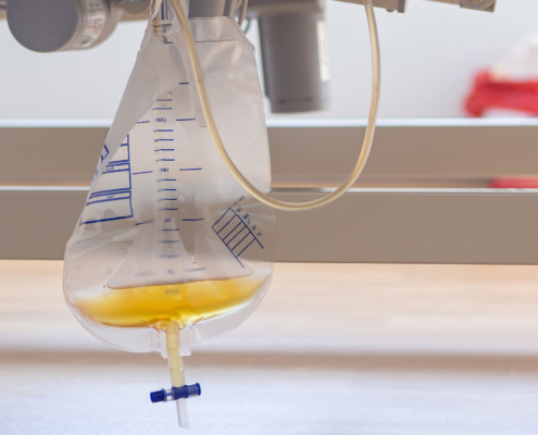 How Hospitals Can Stay Ahead of Drainage Bag Supplier Delays