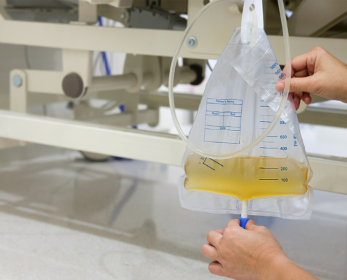 Why Low-Cost Medical Drainage Bags Could Actually Cost You More