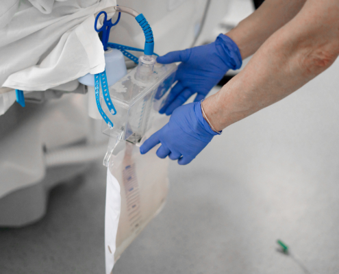 Common Drainage Bag Failures (and How to Prevent Them in Clinical Use-img